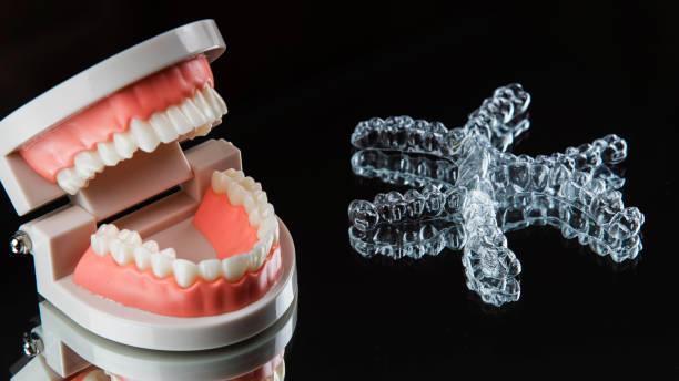 dental care invisalign and dental restorations do they really mix