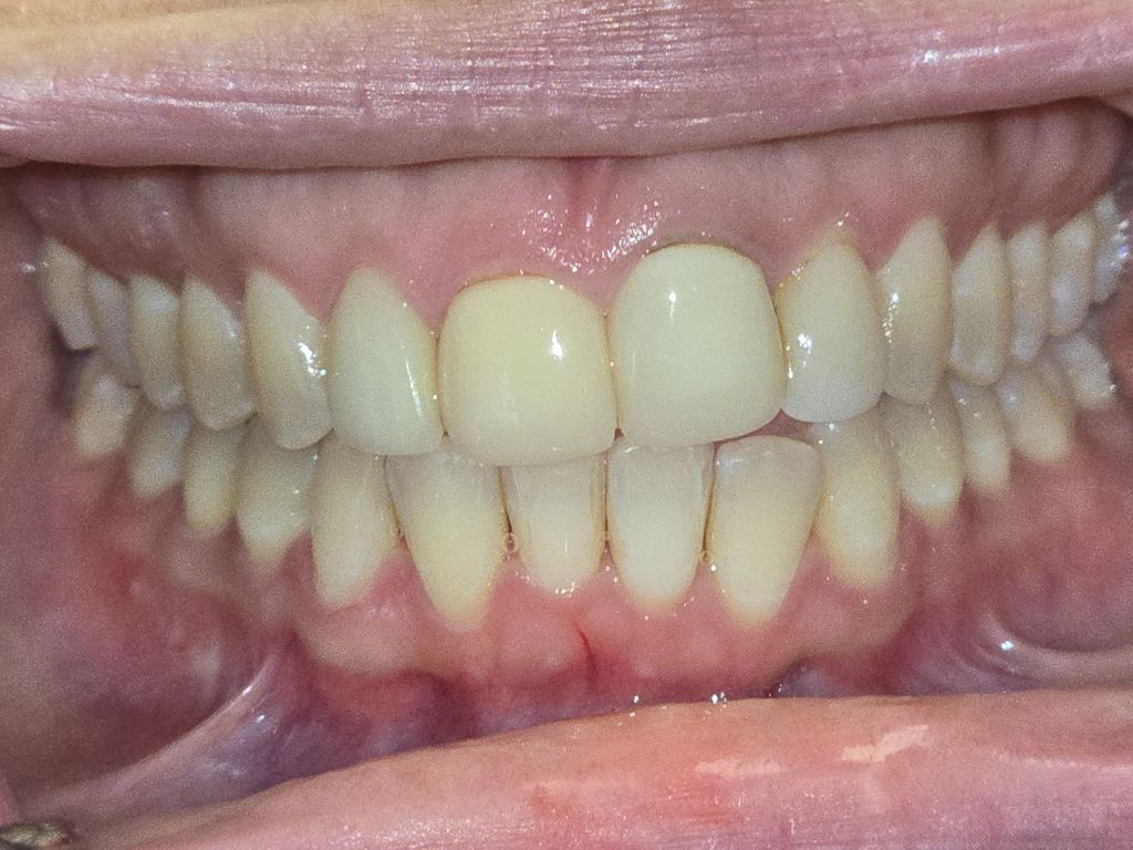 dental care kathryn mcilvain 8 anterior