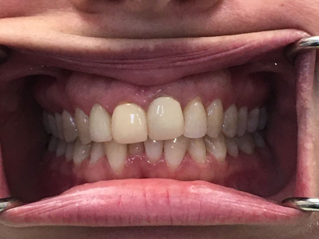 dental care kathryn mcilvain 8 anterior1